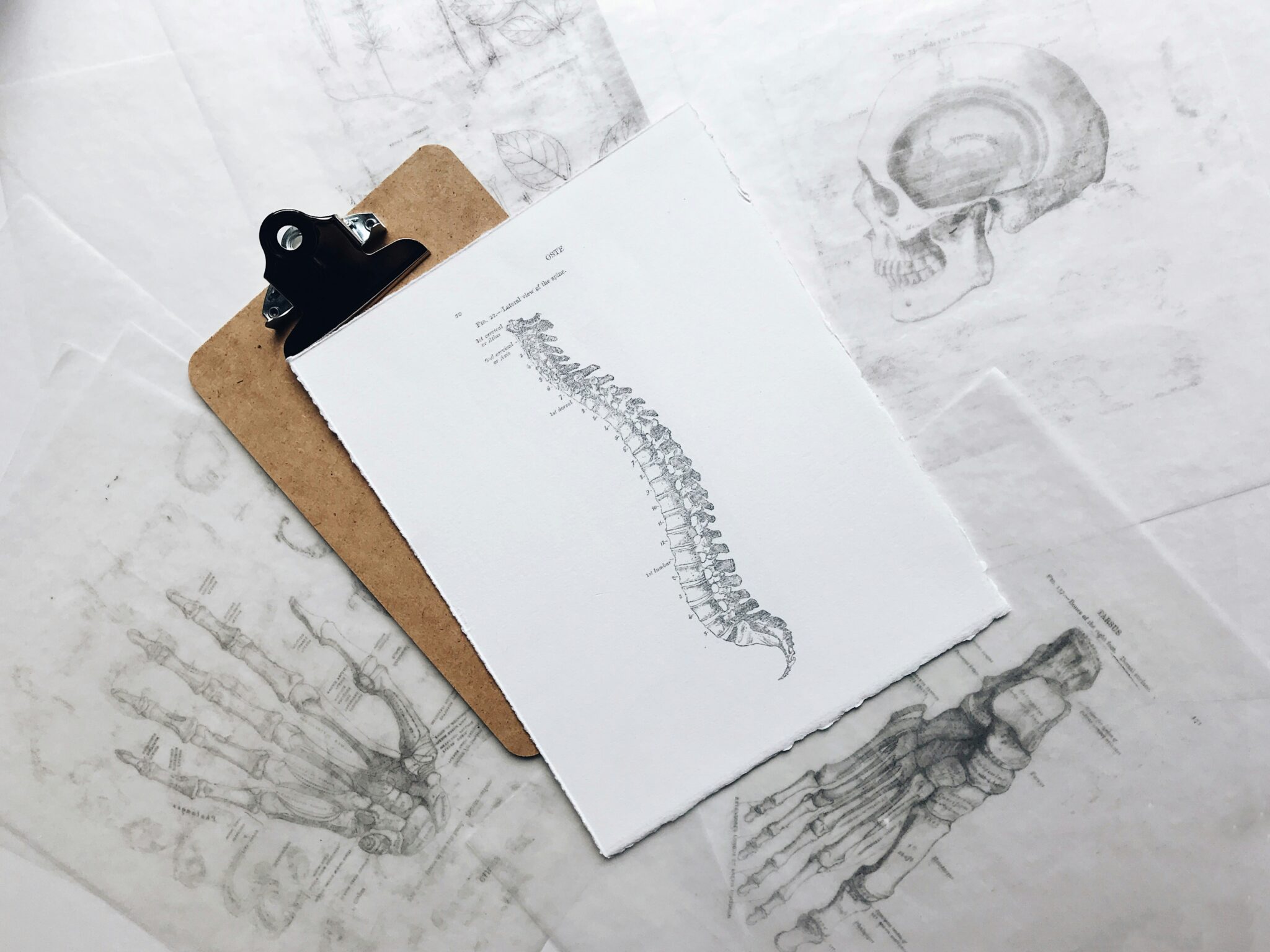 Risks of A Spinal Epidural Haematoma (SEH)