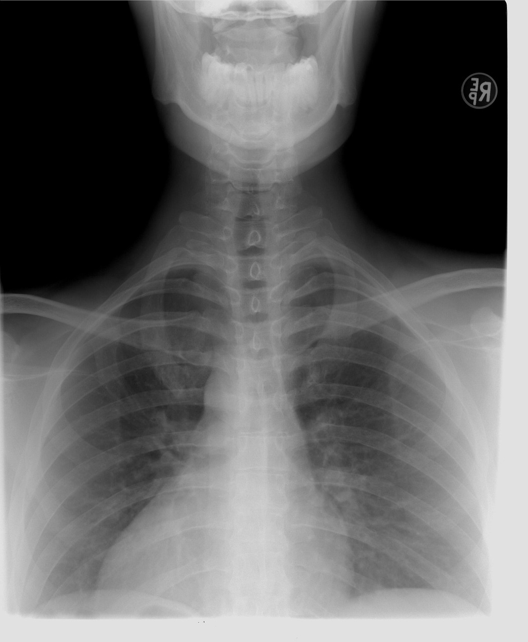 Medical Scan Mistakes Leading to Harm