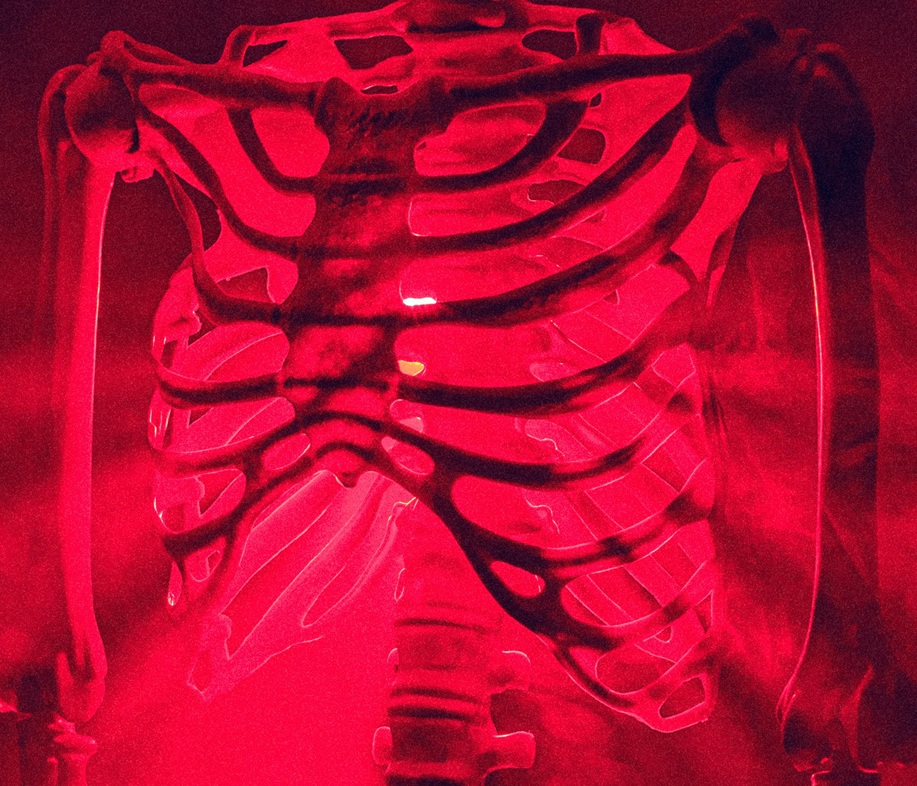 Missed Rib Fracture Claims
