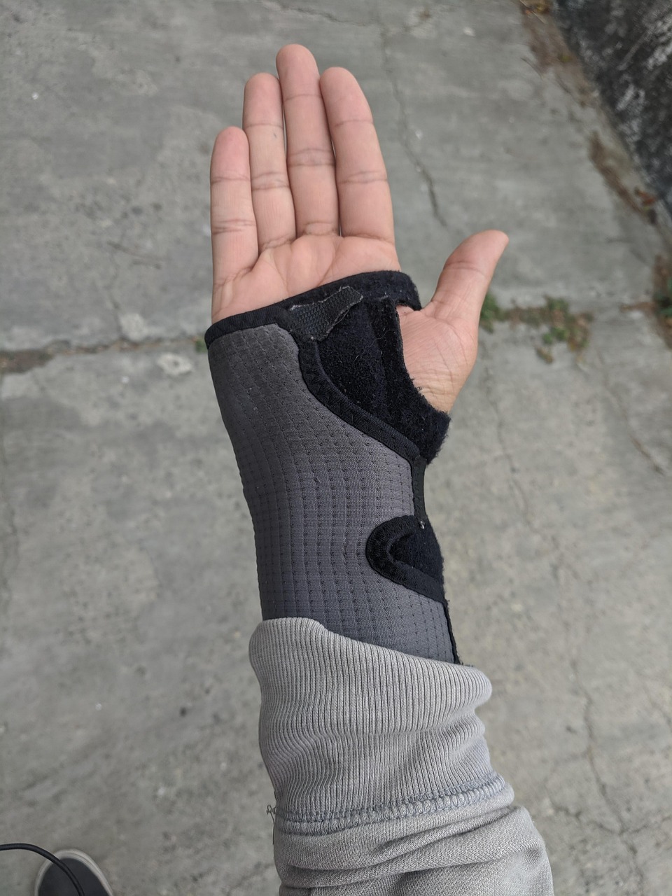 How To Claim For Work-Related Osteoarthritis