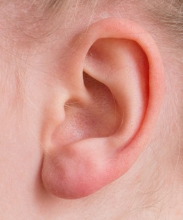 How to Claim Compensation for a Faulty Cochlear Implant