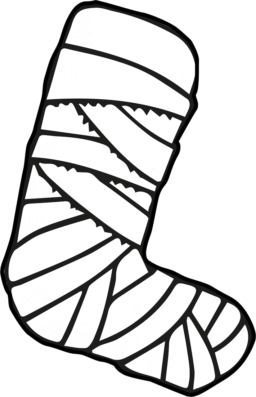 Broken Foot at Work – What Compensation Can You Expect?