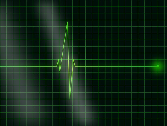 Compensation for Missed Acute Coronary Syndrome (ACS) 