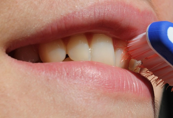 Claim Compensation for a Failed Root Canal